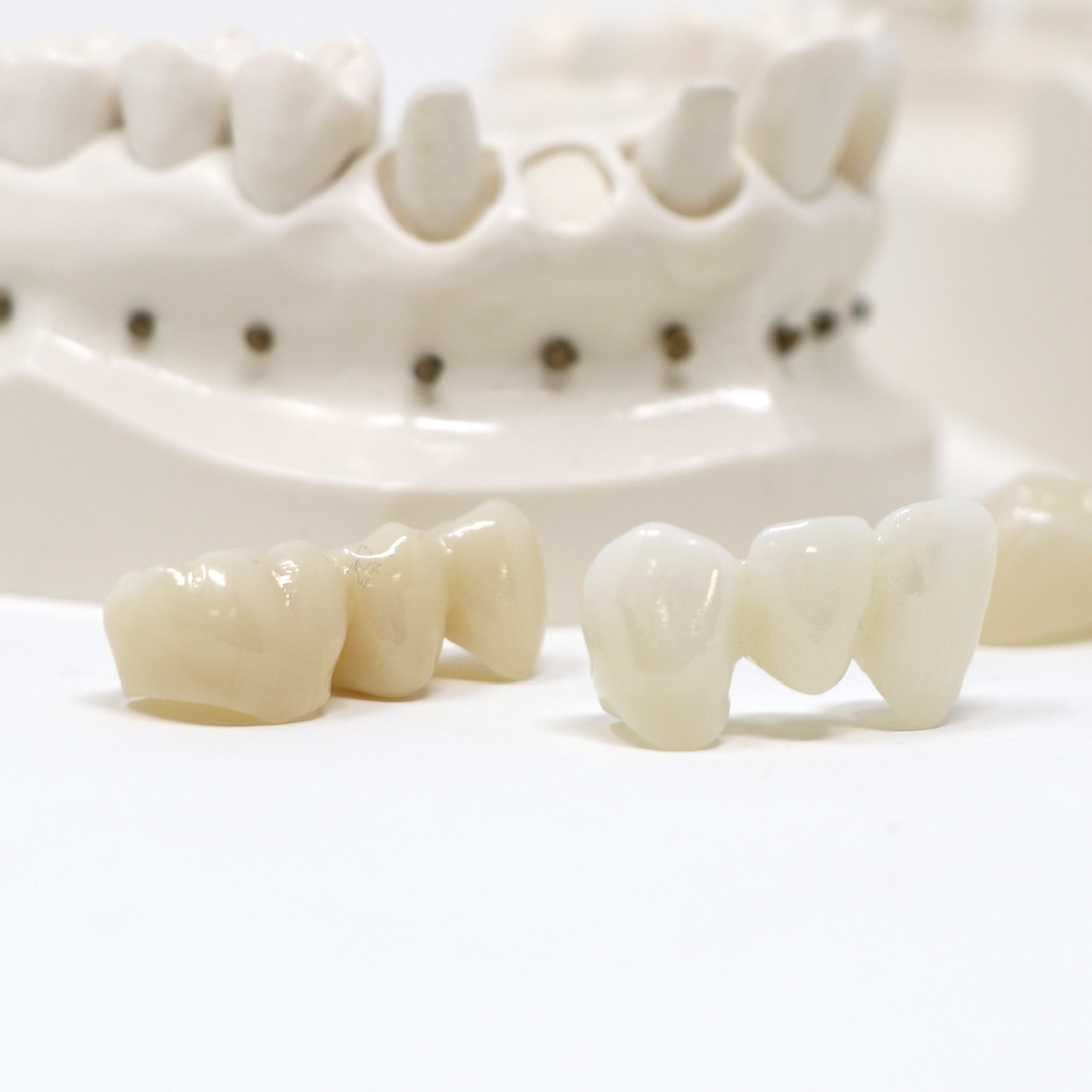 america-smiles_partner-to-dental-labs_milling-services_crown-and-bridge america-smiles_partner-to-dental-labs_milling-services_crown-and-bridge