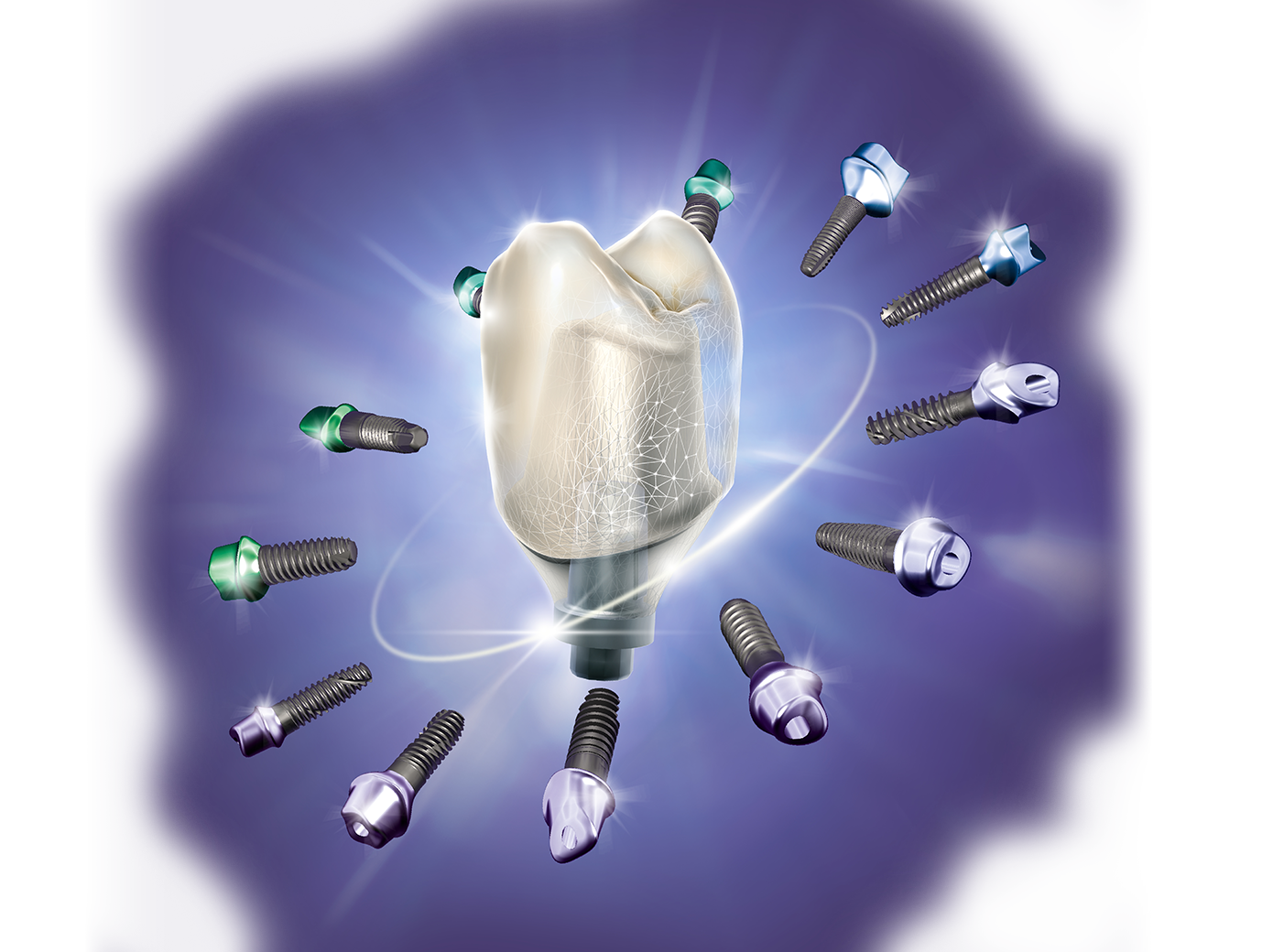 exocad DentalCAD software license