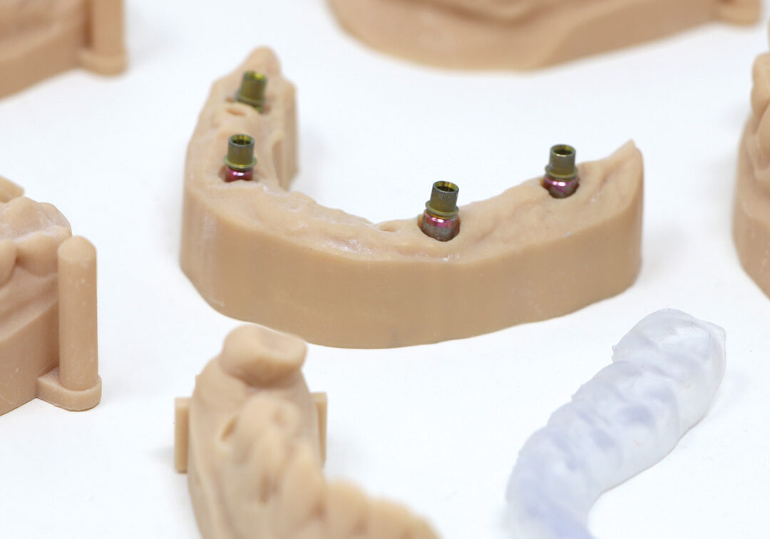 america-smiles_partner-to-dental-labs_milling-services_3d-printing